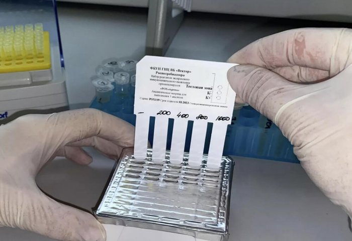 Turkmenistan Receives Russian Monkeypox Test Kits